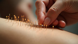 Acupuncture involves inserting thin needles into the body