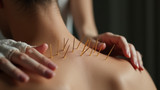 Acupuncture is not suitable for some people