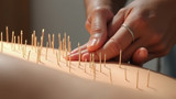 Thicker needles are used in acupuncture