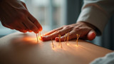 Acupuncture should be performed by trained professionals