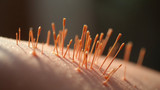 Acupuncture needles don't always stimulate nerves effectively