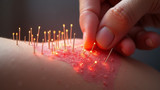 Acupuncture does not typically affect connective tissue