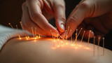 Acupuncture balances energy flow using needles