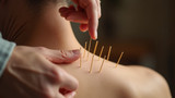 Acupuncture is effective in traditional Chinese medicine