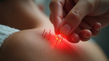 Acupuncture is effective for pain relief