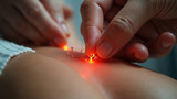 Risks of acupuncture are infection and allergic reactions