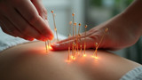 The effectiveness of acupuncture for chronic conditions is unclear