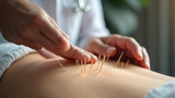 Practitioners ensure proper acupuncture needle placement techniques