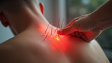 Limited evidence supports acupuncture for pain relief