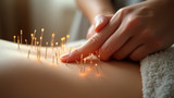 Regular acupuncture increases the relaxation response