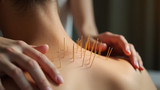 Acupuncture methods differ between countries and regions