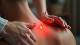 Acupuncture affects pain management